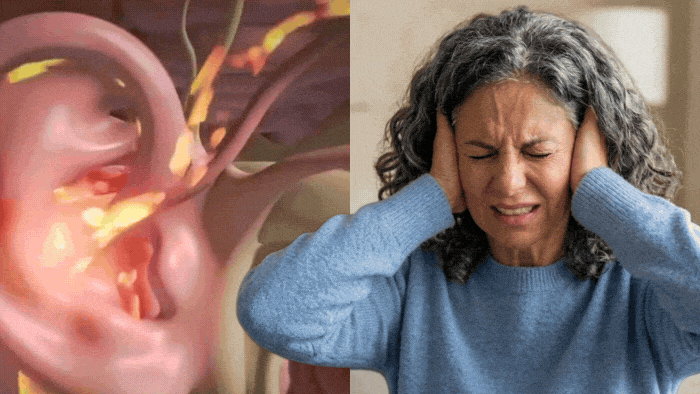 Ringing in ears animation